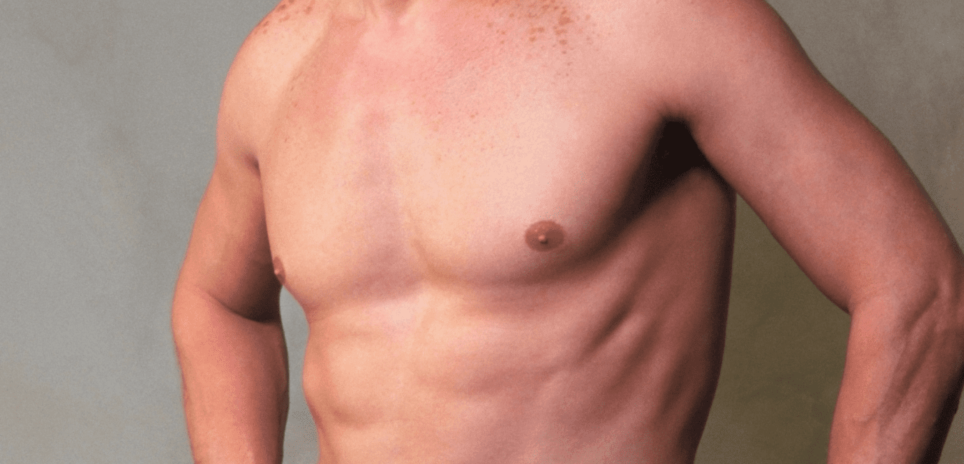 mastectomia en IM GENDER