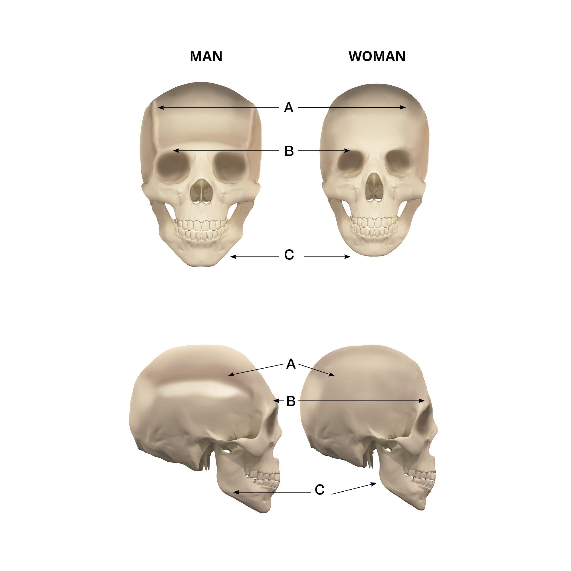 facial-feminization-cranium Diferencias entre cráneo masculino y femenino
