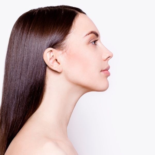 Trans woman poses after nose feminization