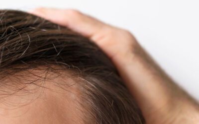 Forehead reduction: What does it consist of?