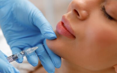 Facial feminization with hyaluronic acid