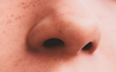 How to Feminize the Nose
