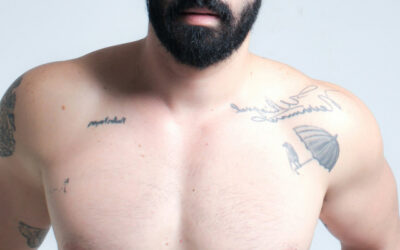 Chest masculinization in trans people